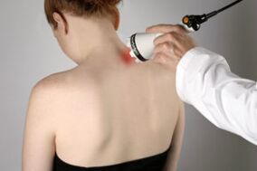 Laser terapia